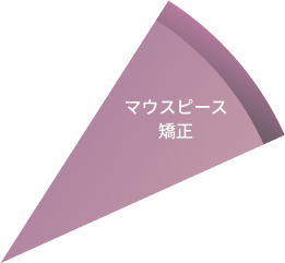 マウスピース矯正